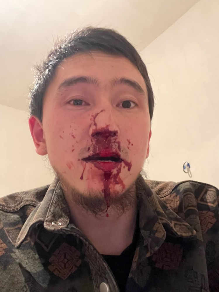 Un croyant du Kirghizistan blessé par des extrémistes